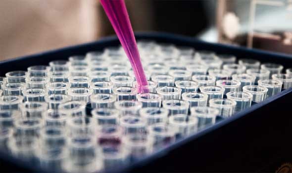 نمو “أدمغة صغيرة” من خلايا بشرية في المختبر قد يحل لغز اضطراب طيف التوحد